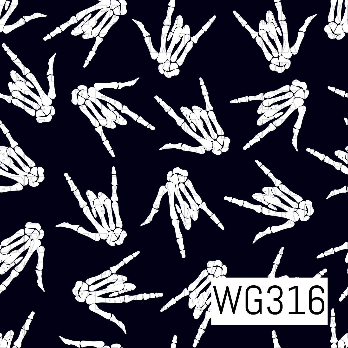 Radiology Hand WG316